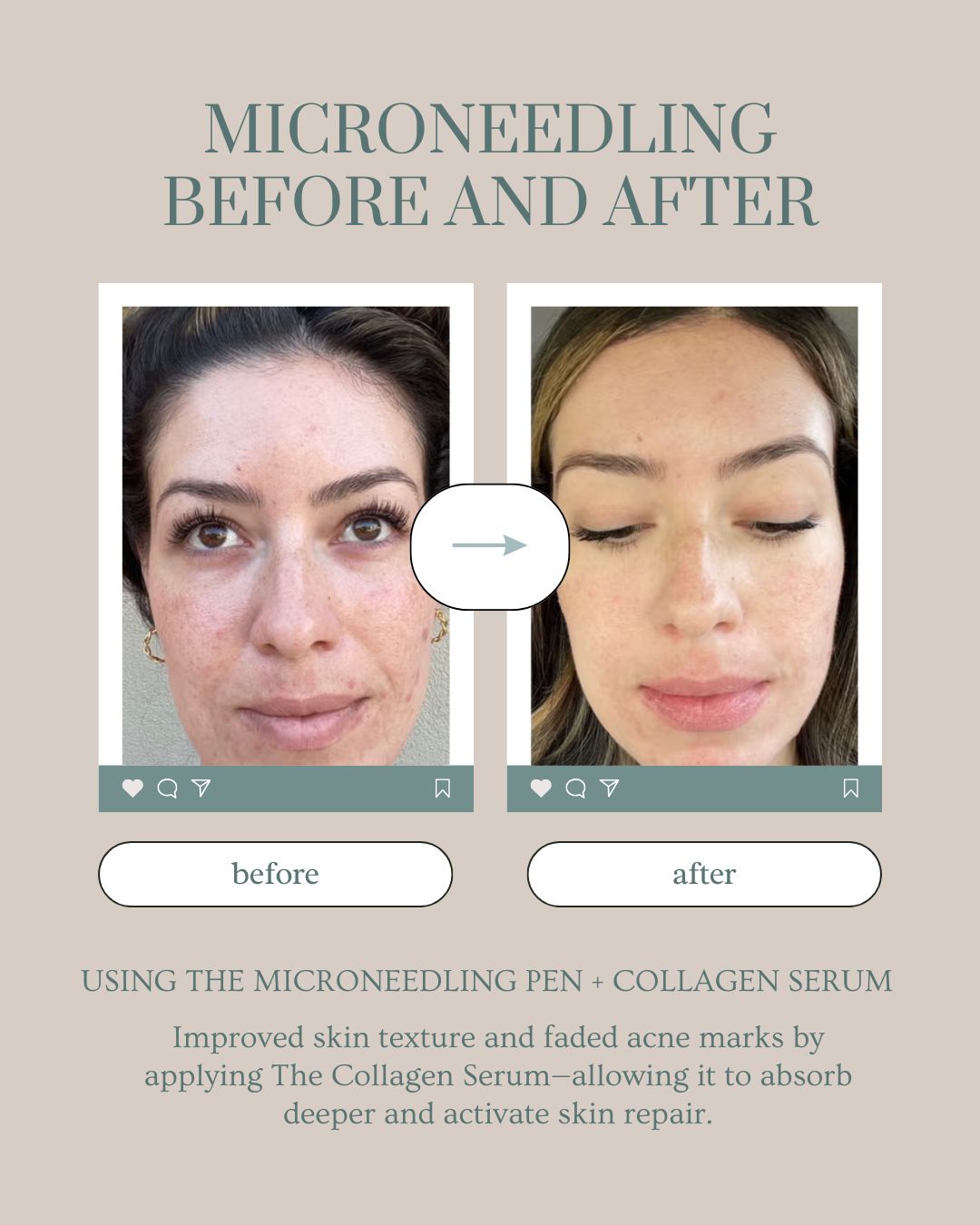 Dr. Pen M8 Microneedling Pen by SolRay Beauty