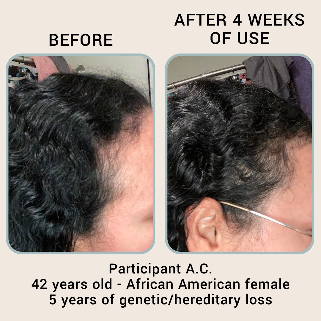 The Hair Revival Serum by BABY|MAMA