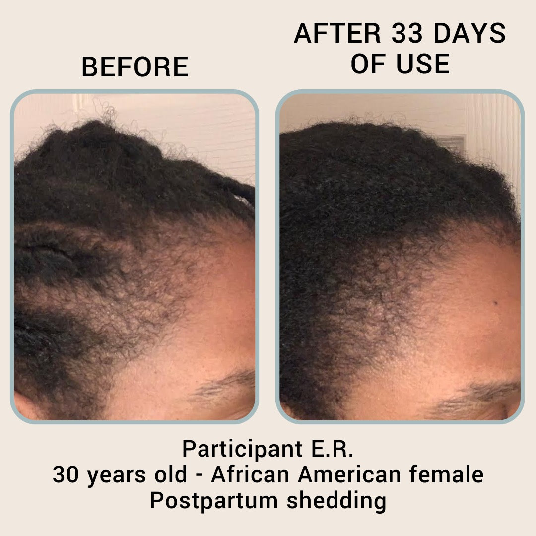 The Hair Revival Serum by BABY|MAMA