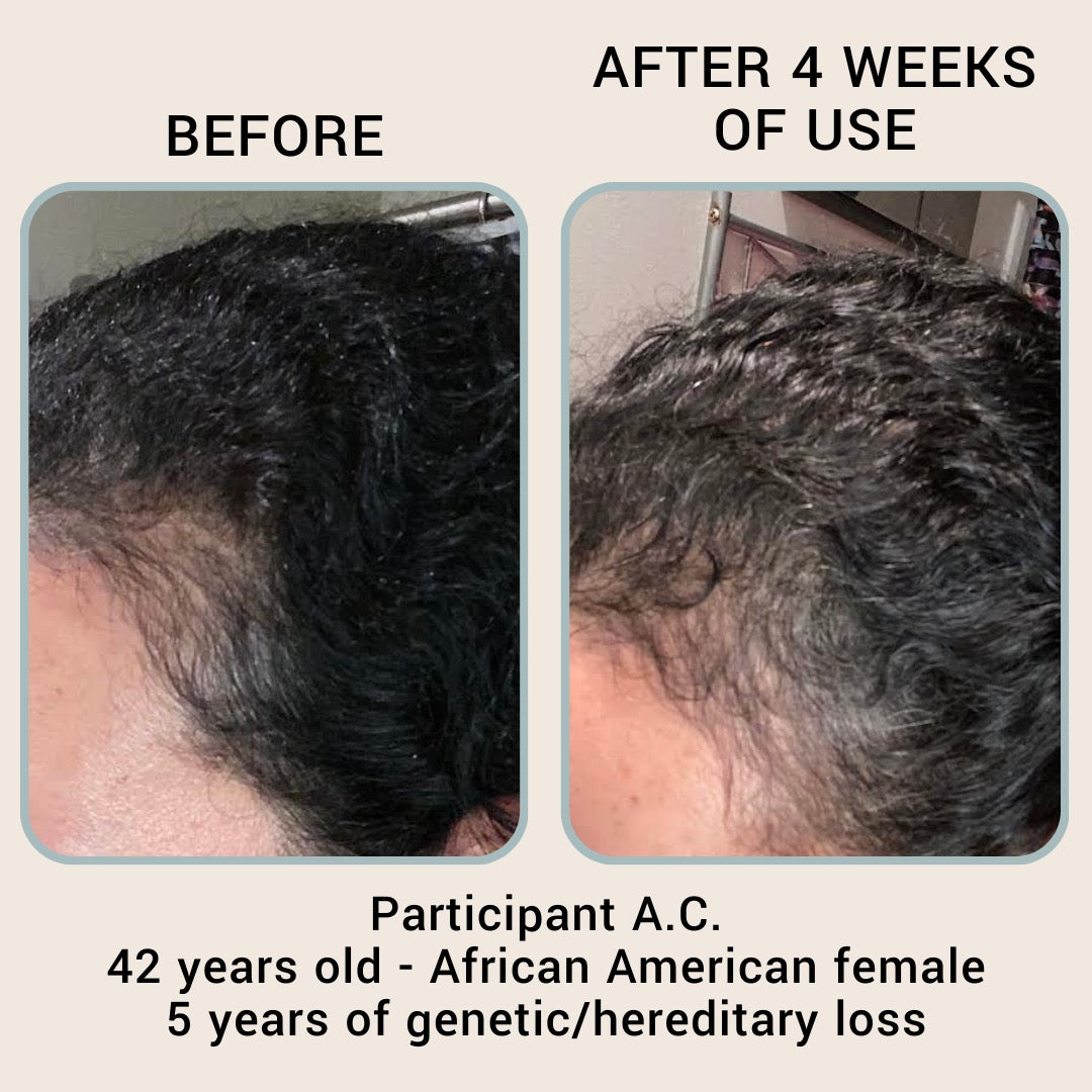 The Hair Revival Serum by BABY|MAMA