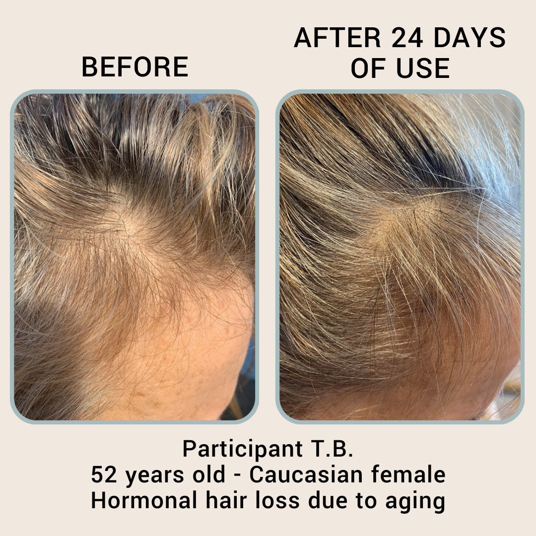 The Hair Revival Serum by BABY|MAMA